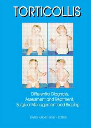 Torticollis: Differential Diagnosis, Assessment and Treatment, Surgical Management and Bracing de Karen Karmel-Ross