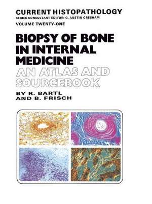 Biopsy of Bone in Internal Medicine de R. Bartl