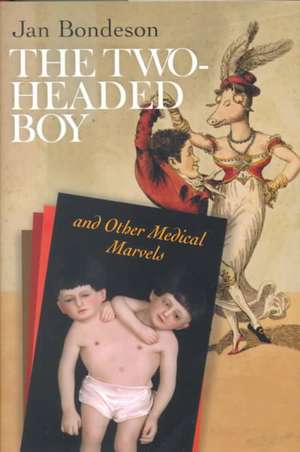 The Two–headed Boy, and Other Medical Marvels de Jan Bondeson