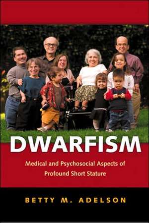 Dwarfism de Betty M Adelson