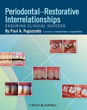 Periodontal–Restorative Interrelationships – Ensuring Clinical Success de Fugazzotto