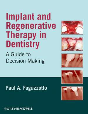 Implant and Regenerative Therapy de PA Fugazzotto