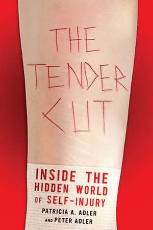 The Tender Cut – Inside the Hidden World of Self–Injury de Patricia A. Adler