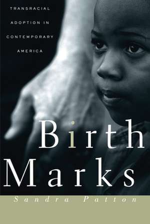Birthmarks de Sandra Patton-Imani