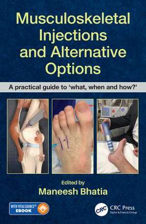 Musculoskeletal Injections and Alternative Options: A practical guide to 'what, when and how?' de Maneesh Bhatia