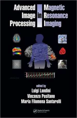 Advanced Image Processing in Magnetic Resonance Imaging de Luigi Landini