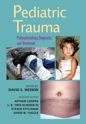 Pediatric Trauma: Pathophysiology, Diagnosis, and Treatment de David Wesson