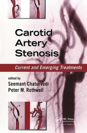 Carotid Artery Stenosis: Current and Emerging Treatments de Seemant Chaturvedi