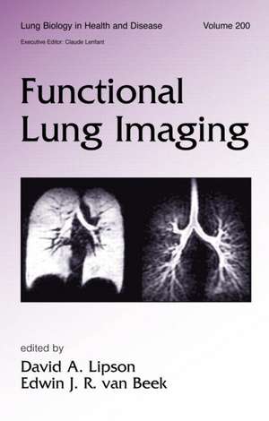 Functional Lung Imaging de David Lipson