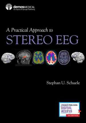 A Practical Approach to Stereo Eeg de Stephan Schuele