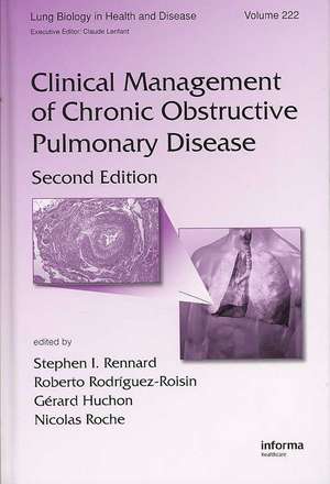 Clinical Management of Chronic Obstructive Pulmonary Disease de Stephen I. Rennard