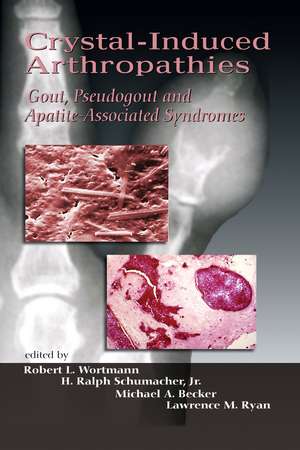 Crystal-Induced Arthropathies: Gout, Pseudogout and Apatite-Associated Syndromes de Robert L. Wortmann