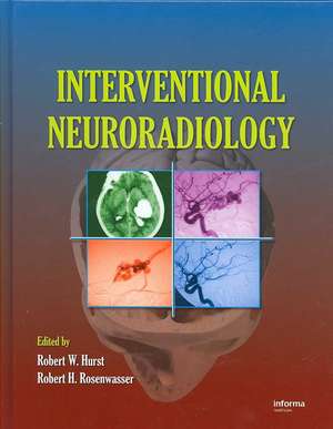 Interventional Neuroradiology de Robert W. Hurst