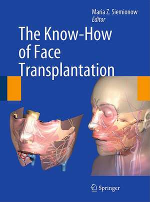 The Know-How of Face Transplantation de Maria Z. Siemionow