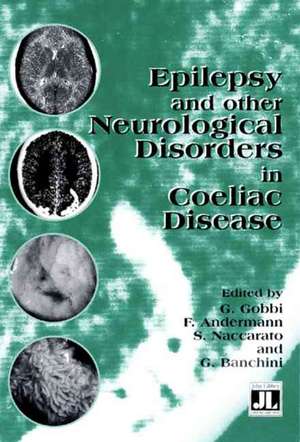 Epilepsy and Other Neurological Disorders in Coeliac Disease de Giuseppe Gobbi