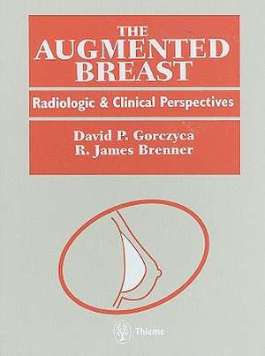 The Augmented Breast: Radiologic and Clinical Perspectives de David P. Gorczyca