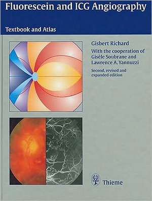 Fluorescein and ICG Angiography: Textbook and Atlas de Gisbert Richard