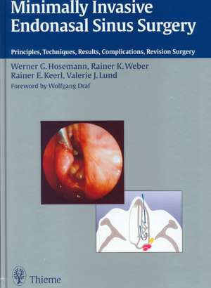 Minimally Invasive Endonasal Sinus Surgery: Principles, Techniques, Results, Complications, Revision Surgery de Werner Goetz Hosemann