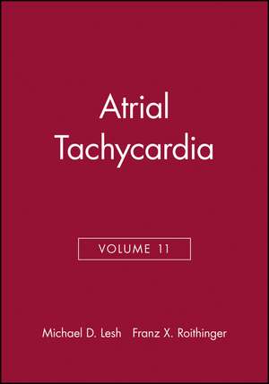 Atrial Tachycardia de MD Lesh