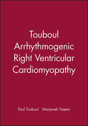 Arrhythmogenic Right Ventricular Cardiomyopathy de P Touboul