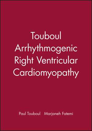 Arrhythmogenic Right Ventricular de Touboul