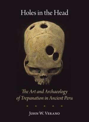 Holes in the Head – The Art and Archaeology of Trepanation in Ancient Peru de John W. Verano