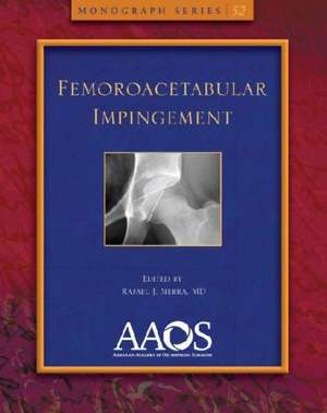 Femoroacetabular Impingement de Rafael J. Ed. Sierra