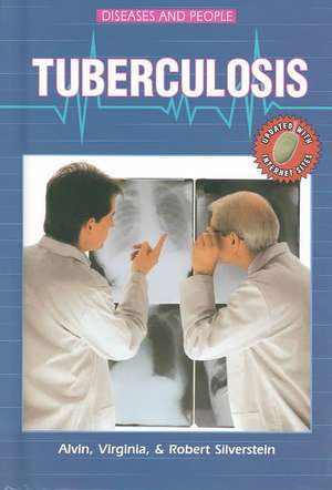 Tuberculosis de Alvin Silverstein