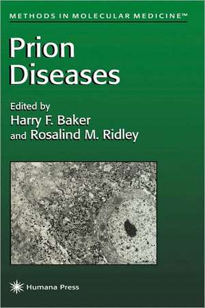 Prion Diseases de Harry F. Baker