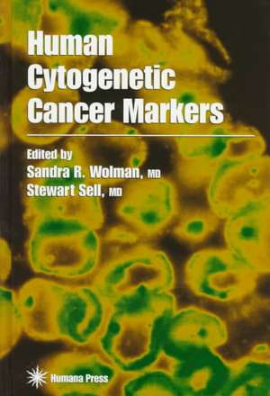 Human Cytogenetic Cancer Markers de Sandra R. Wolman