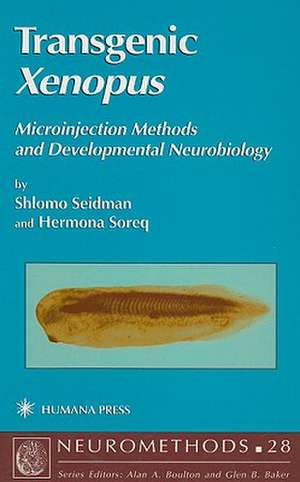 Transgenic Xenopus: Microinjection Methods and Developmental Neurobiology de Shlomo Seidman