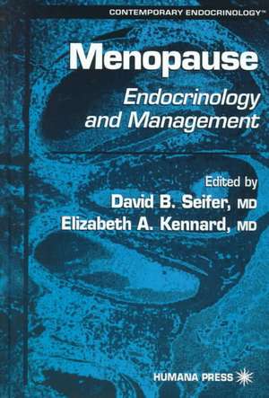 Menopause: Endocrinology and Management de David B. Seifer