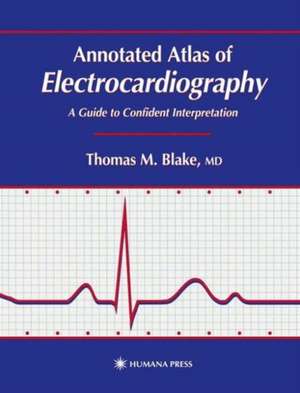 Annotated Atlas of Electrocardiography: A Guide to Confident Interpretation de Thomas M. Blake