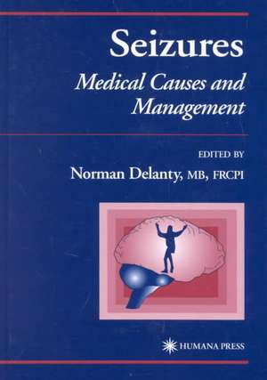 Seizures: Medical Causes and Management de Norman Delanty