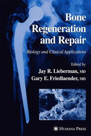 Bone Regeneration and Repair: Biology and Clinical Applications de Jay R. Lieberman