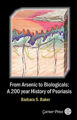 From Arsenic to Biologicals: A 200 Year History of Psoriasis de Barbara S. Baker