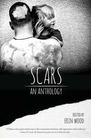 Scars de Erin Wood