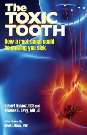 The Toxic Tooth de Dds Robert Kulacz