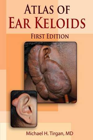 Atlas of Ear Keloids