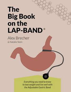 The Big Book on the Lap-Band de Alex Brecher