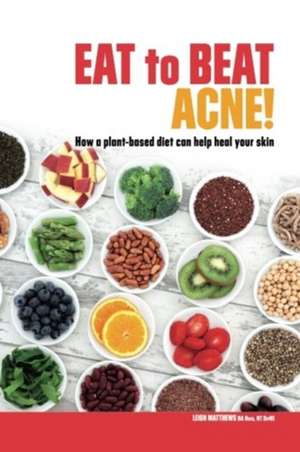 Eat to Beat Acne! de Leigh Matthews