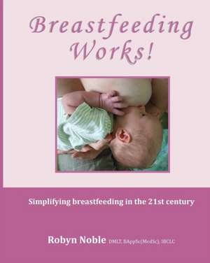 Breastfeeding Works! de Robyn Noble