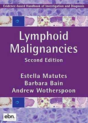 Lymphoid Malignancies de Estella Matutes