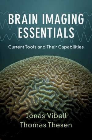 Brain Imaging Essentials de Jonas Vibell