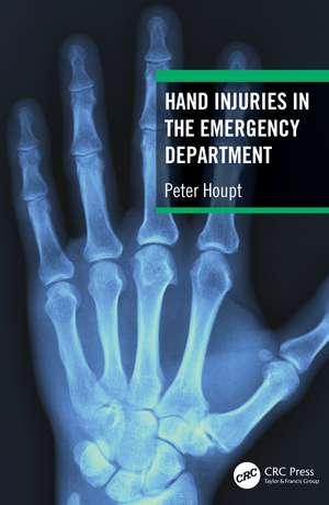 Hand Injuries in the Emergency Department de Peter Houpt