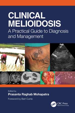 Clinical Melioidosis: A Practical Guide to Diagnosis and Management de Prasanta Raghab Mohapatra