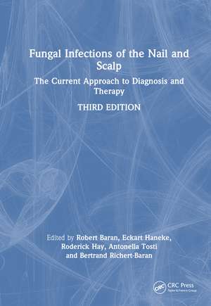 Fungal Infections of the Nail and Scalp: The Current Approach to Diagnosis and Therapy de Robert Baran