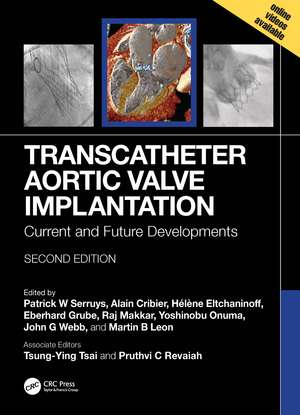 Transcatheter Aortic Valve Implantation: Current and Future Developments de Patrick W. Serruys