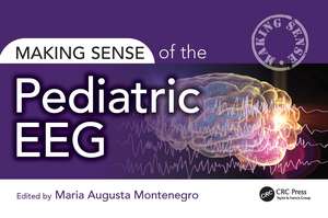 Making Sense of the Pediatric EEG de Maria Montenegro