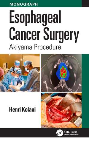 Esophageal Cancer Surgery: Akiyama Procedure de Henri Kolani